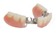 Chrome denture