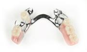 Chrome Denture