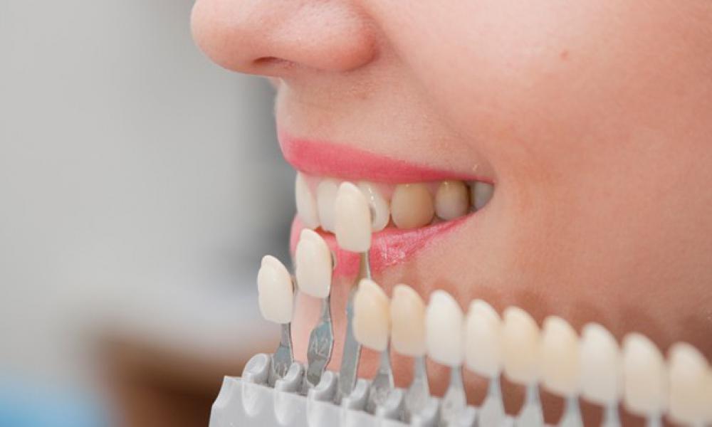 Aesthetic Dentistry